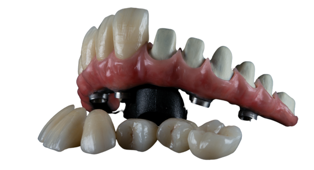 OVERVIEW ABOUT FIXED PROSTHODONTICS HT Dental ART